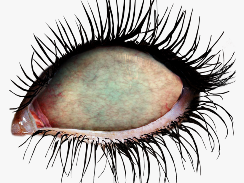 #ftestickers #eye #eyes #zombie #zombieeyes #undead - Zombie Eyes Transparent